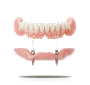 Implanted Dentures