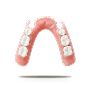 Partial Dentures