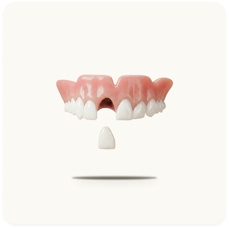 Full Dentures