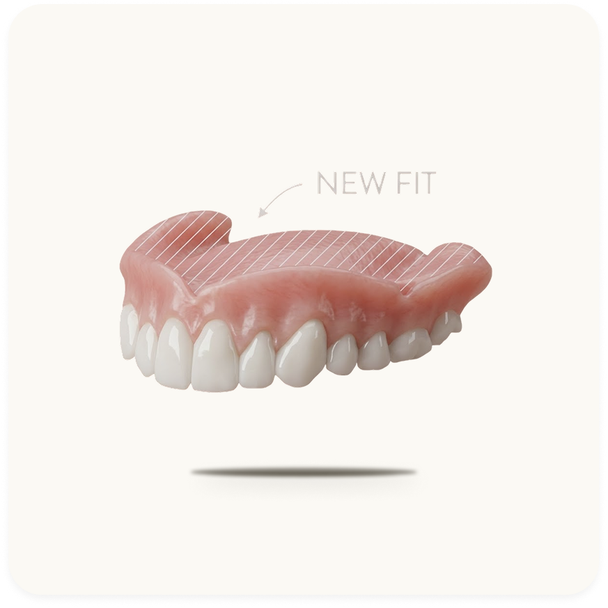 Full Dentures